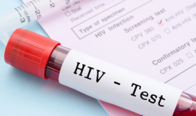 Lotta all’Aids: Asst Valle Olona incontra gli studenti