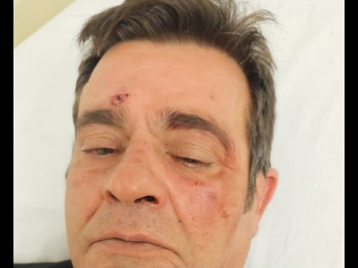 Riprende i bulli vandali, il branco lo pesta di botte