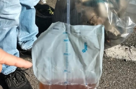 Anche un catetere usato tra i rifiuti raccolti in strada