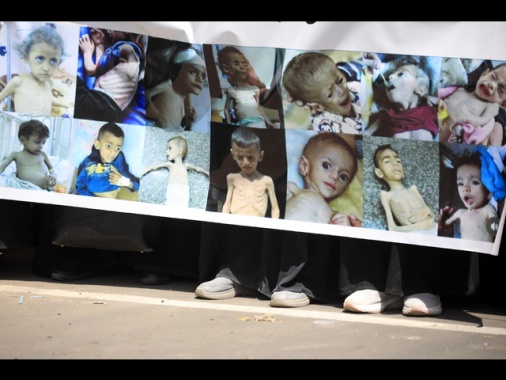 Governo Gaza, 100.000 bimbi rischiano di morire a breve