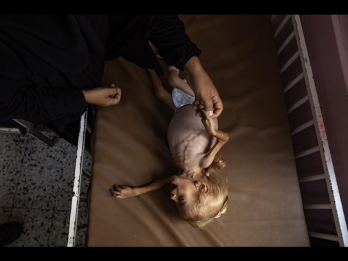 Hamas, 10 morti per malnutrizione in 24 ore tra cui 3 bambini