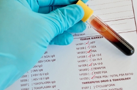 Lotta al cancro, test gratuiti a Varese