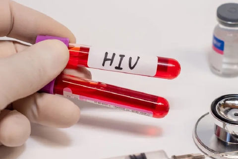 Valle Olona, nascose l’Hiv: condannato