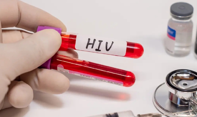 Negli anni Novanta il rischio di contrarre l’Hiv era altissimo: emblematica la campagna per l’uso dei profilattici